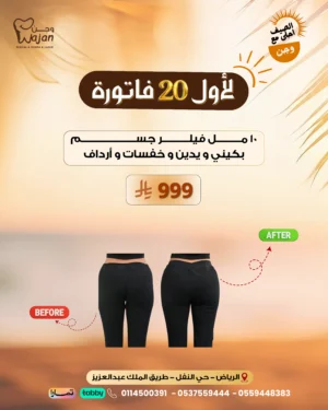فيلر بدي