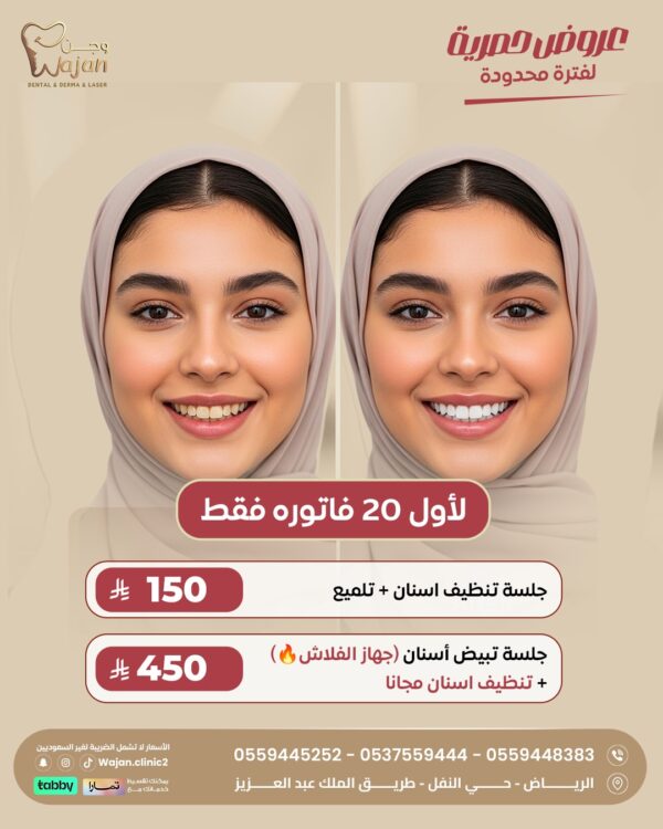 عروض الاسنان ( لأول 20 فاتورة فقط )